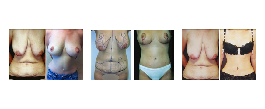 Patients Before and After Photos