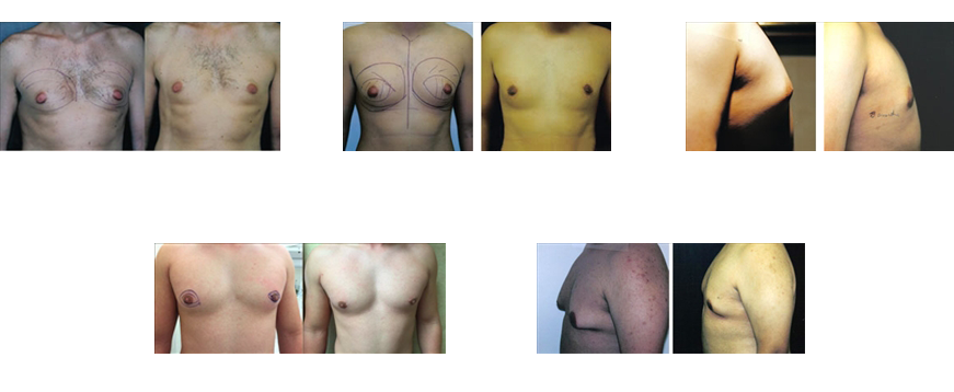 Patients Before and After Photos