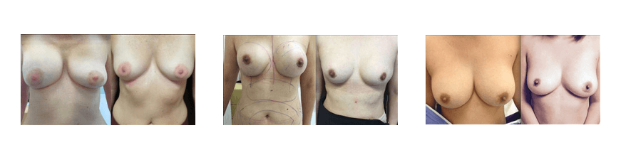 Patients Before and After Photos