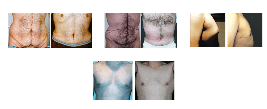 Patients Before and After Photos