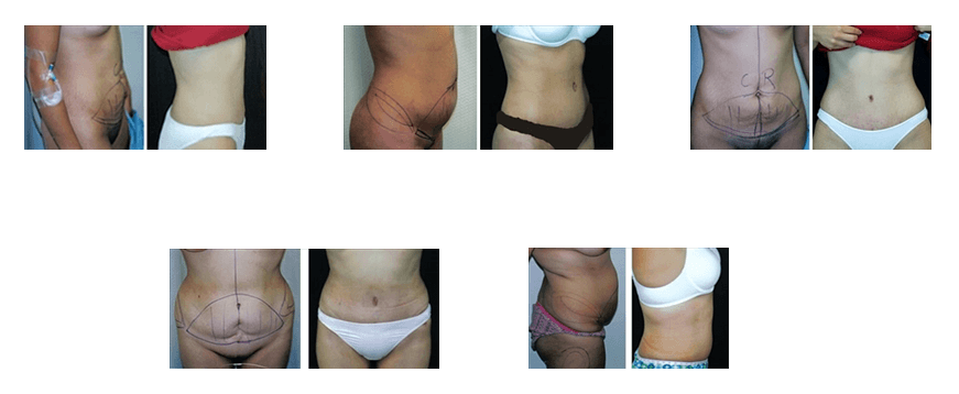 Patients Before and After Photos