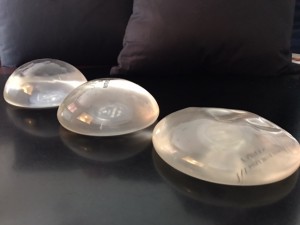 Breast implants