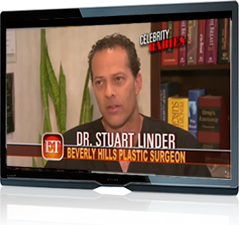 TUMMY TUCK REVISION  Dr. Stuart A. Linder