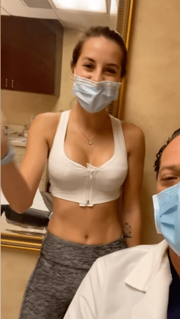 After image showing the results of a breast augmentation