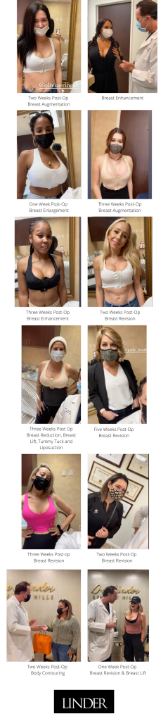 Collection of breast and body contouring patients from Dr. Linder in Beverly Hills, CA.