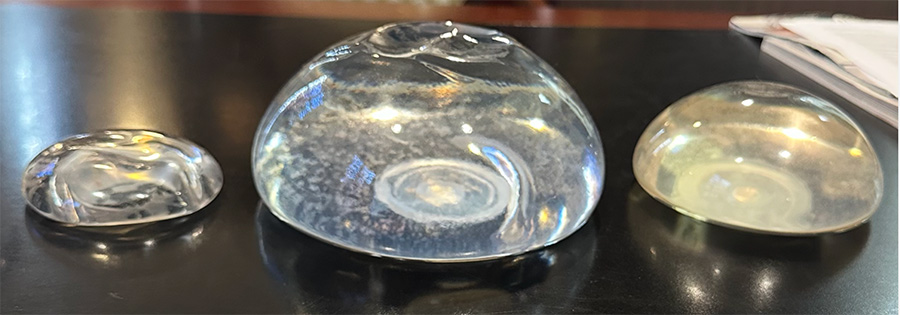 Breast implant
