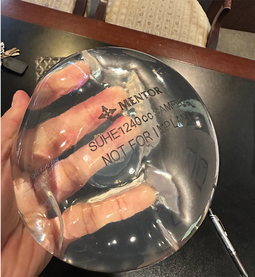 Mentor memory gel implant