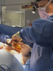 Linder-removing-a-ruptured-saline-breast-implant